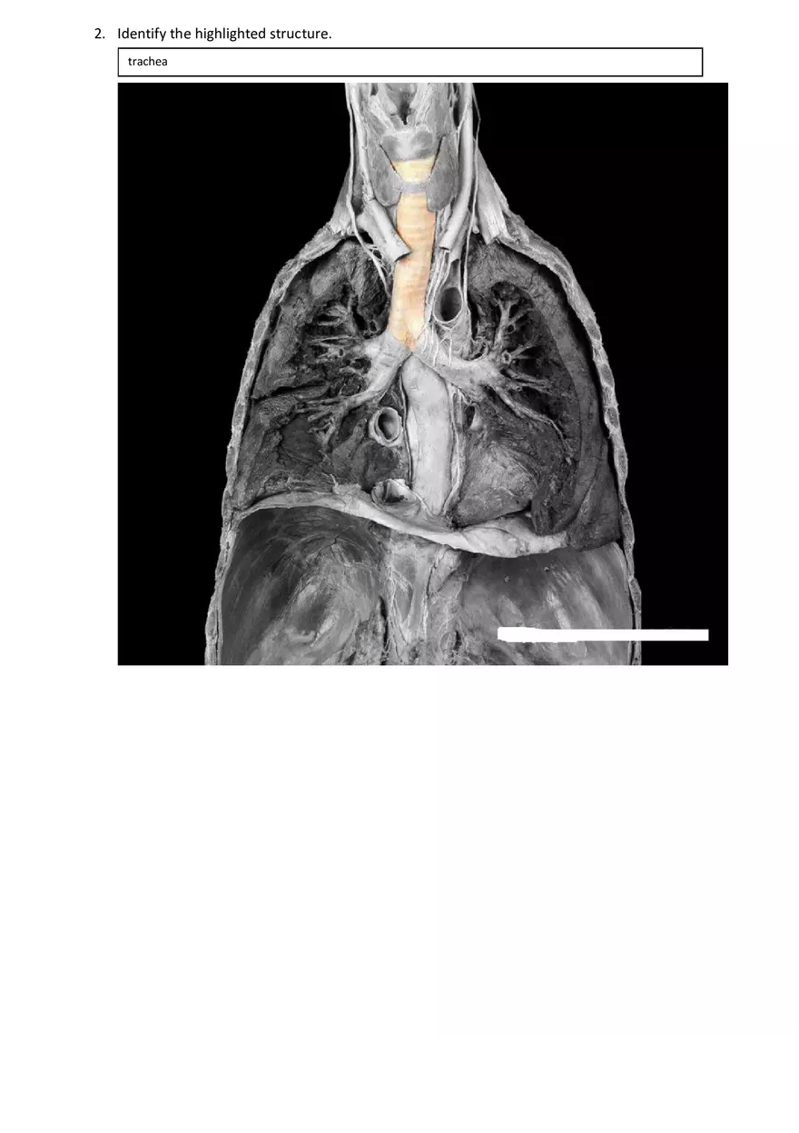 Real Anatomy Worksheet Answer Key Respiratory System - Page 2