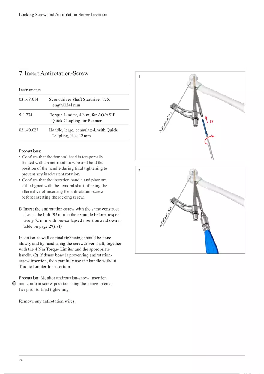 Femoral Neck System Locking Screw and Antirotation-Screw Insertion - Page 7