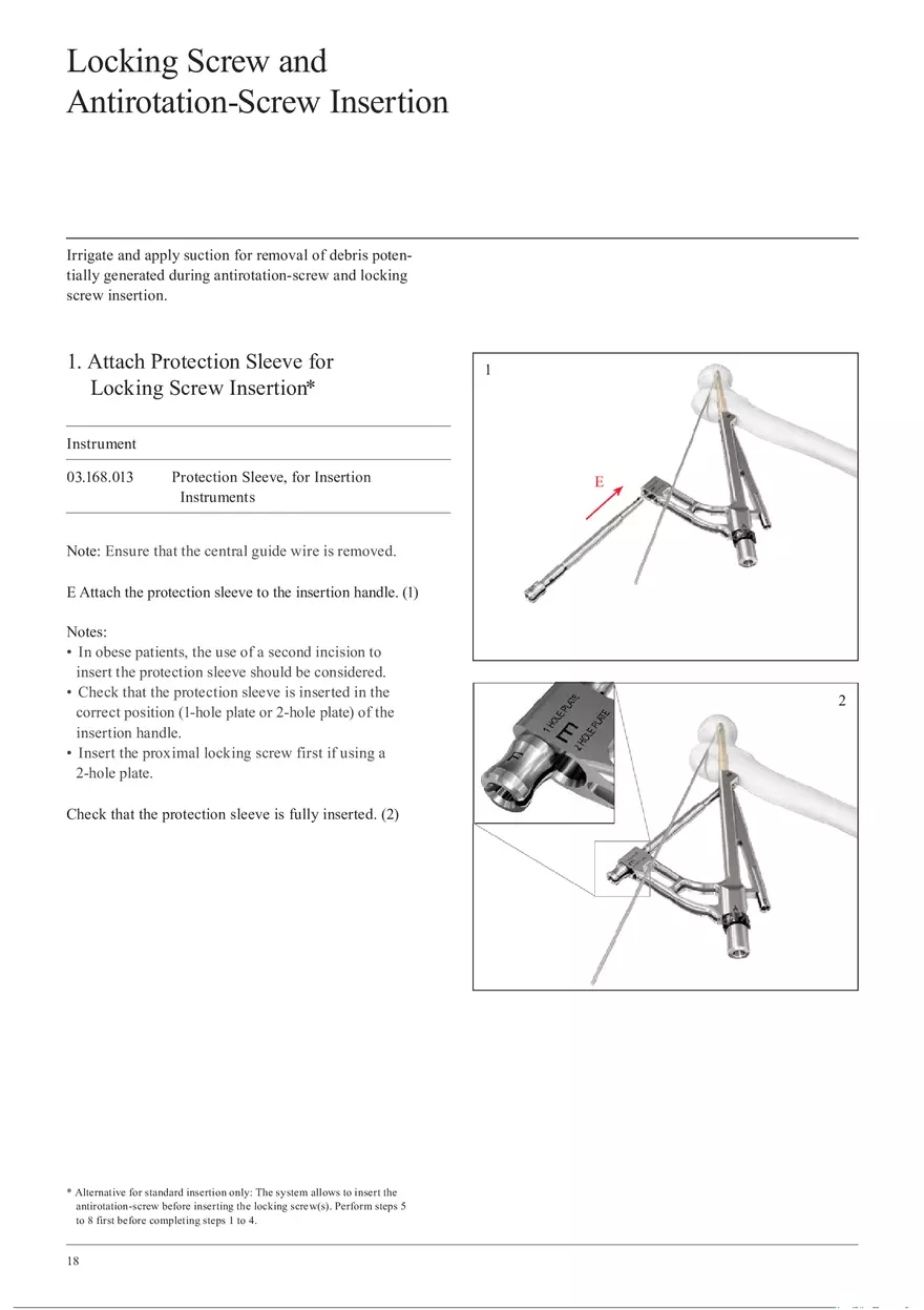 Femoral Neck System Locking Screw and Antirotation-Screw Insertion - Page 1