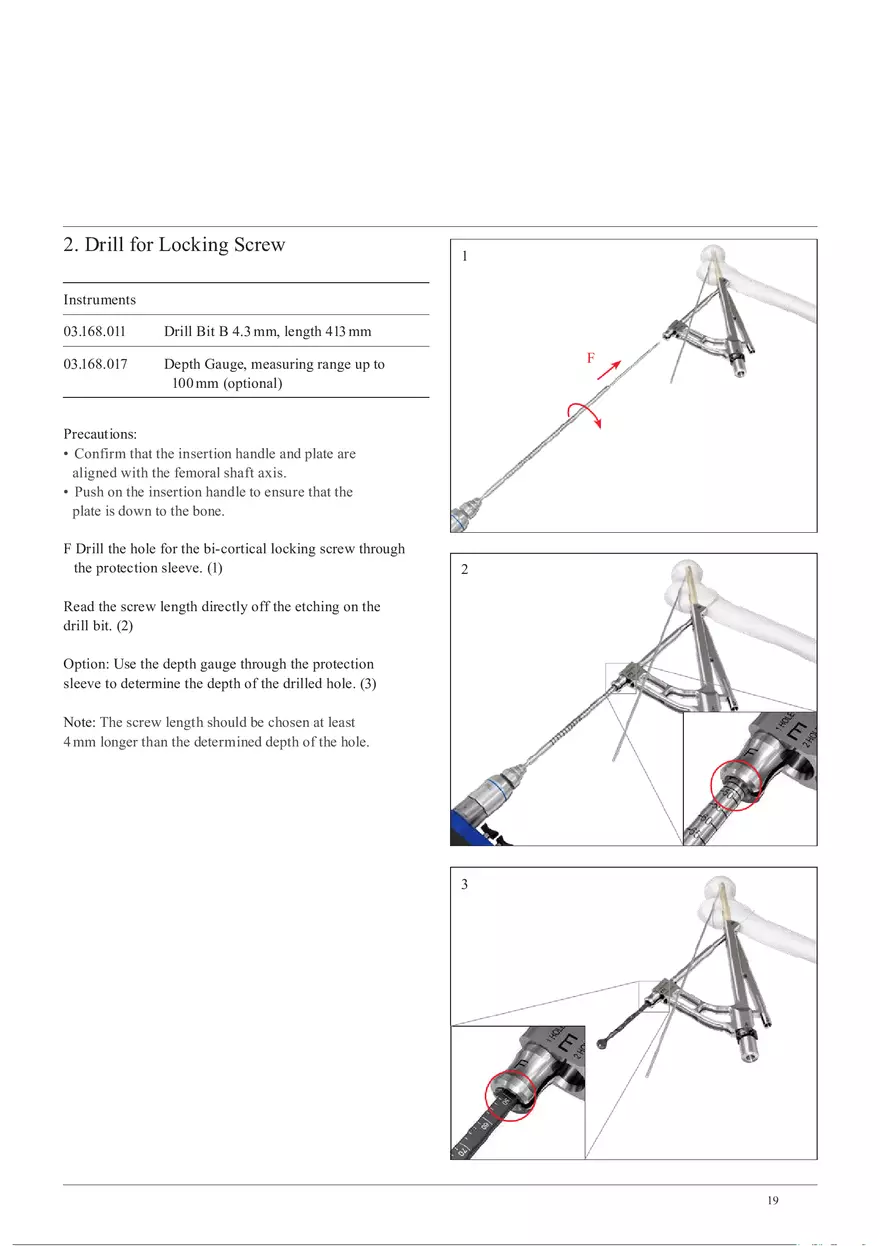 Femoral Neck System Locking Screw and Antirotation-Screw Insertion - Page 2