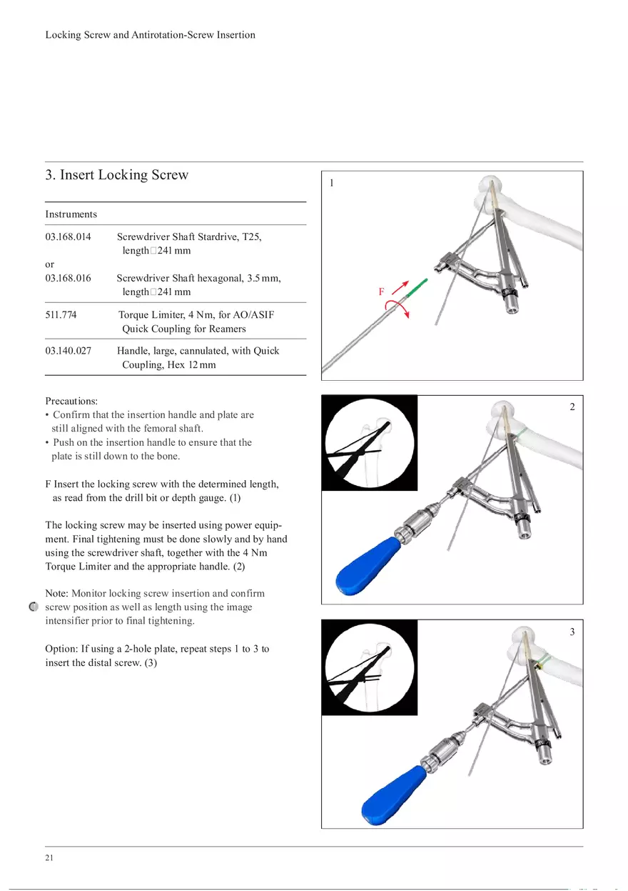 Femoral Neck System Locking Screw and Antirotation-Screw Insertion - Page 3