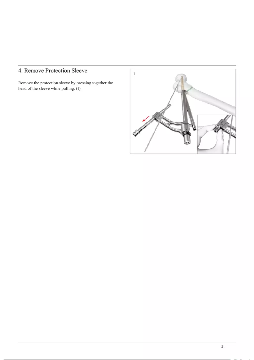 Femoral Neck System Locking Screw and Antirotation-Screw Insertion - Page 4