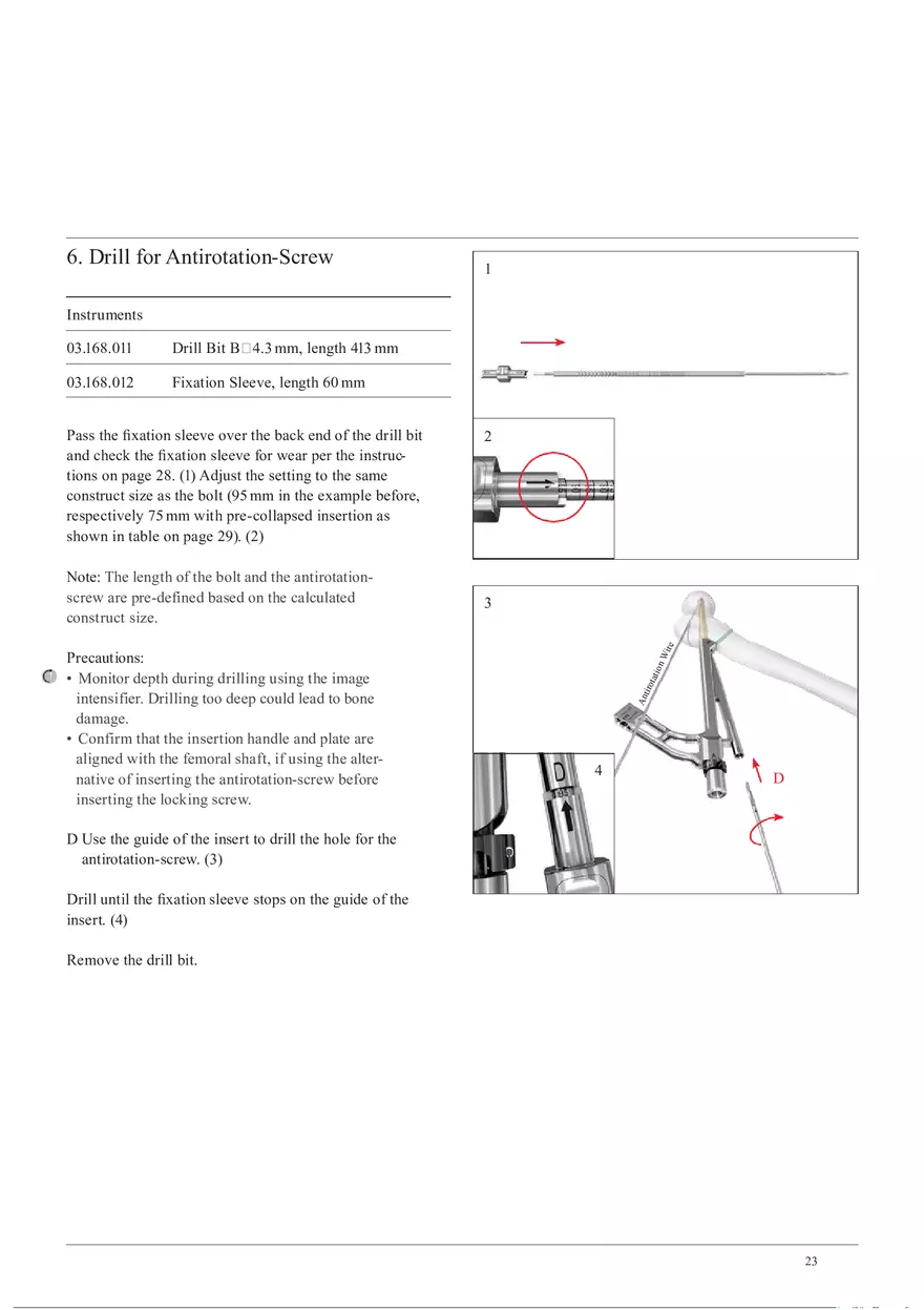 Femoral Neck System Locking Screw and Antirotation-Screw Insertion - Page 6