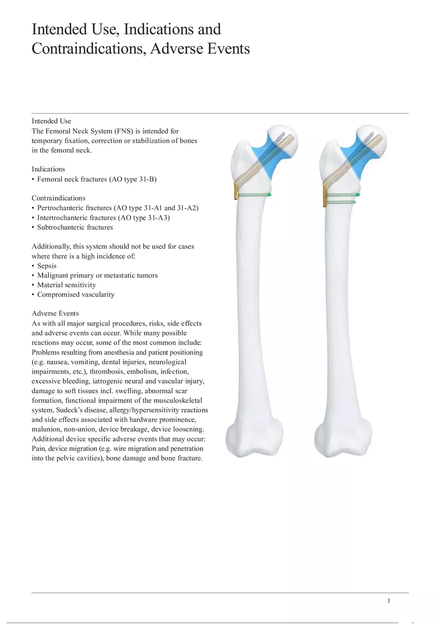 Femoral Neck System The AO Principles of Fracture Management - Page 2