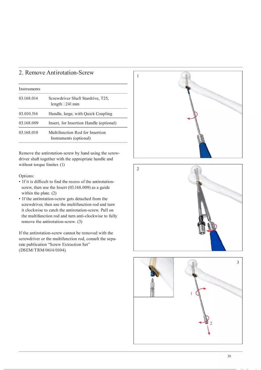 Femoral Neck Checking Option Implant Removal - Page 2