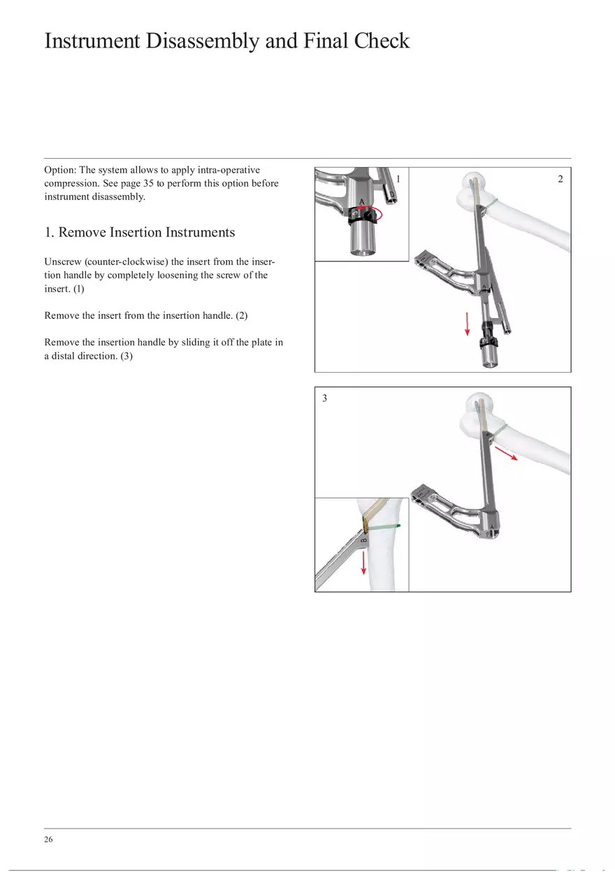 Femoral Neck System Instrument Disassembly and Final Check - Page 1