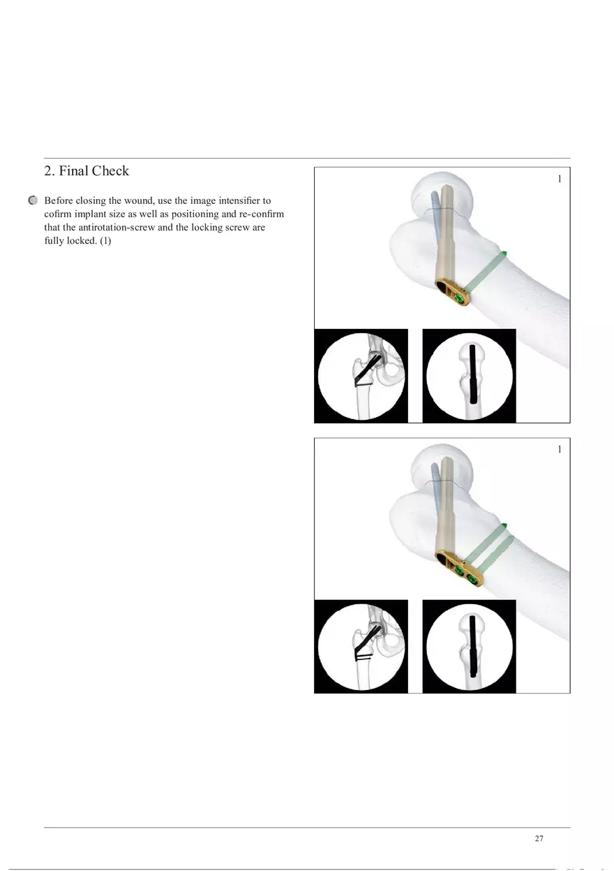 Femoral Neck System Instrument Disassembly and Final Check - Page 2