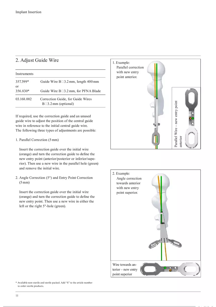 Femoral Neck System Implant Insertion - Page 2