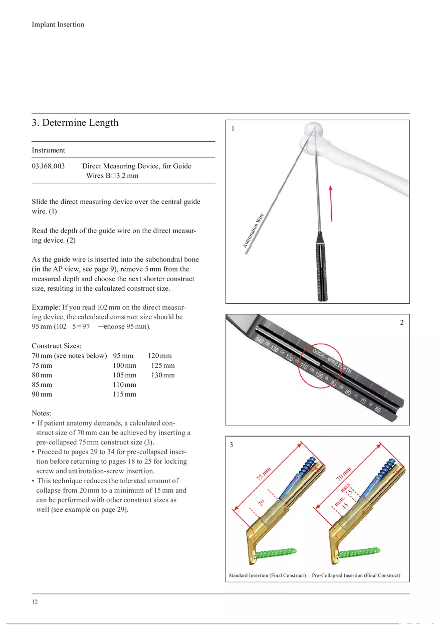 Femoral Neck System Implant Insertion - Page 4