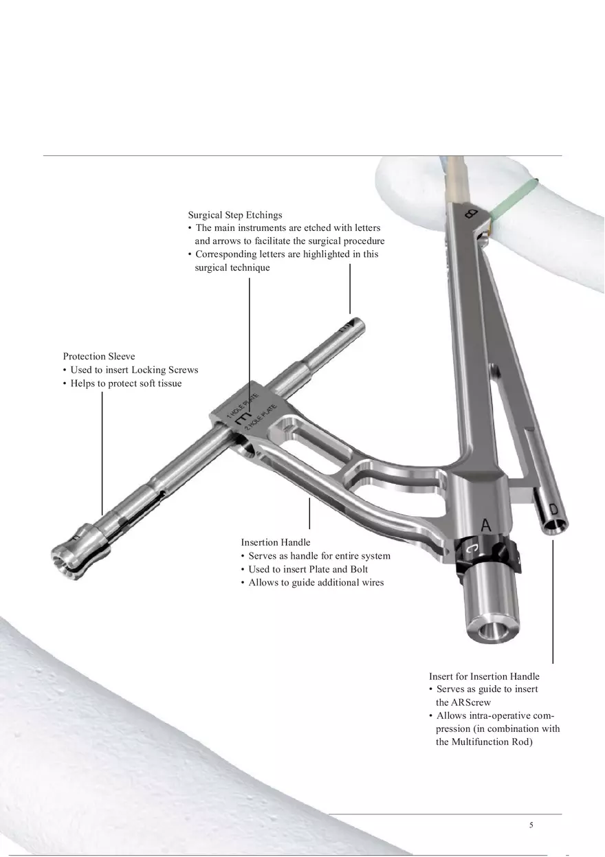 Femoral Neck System System Highlights - Page 2