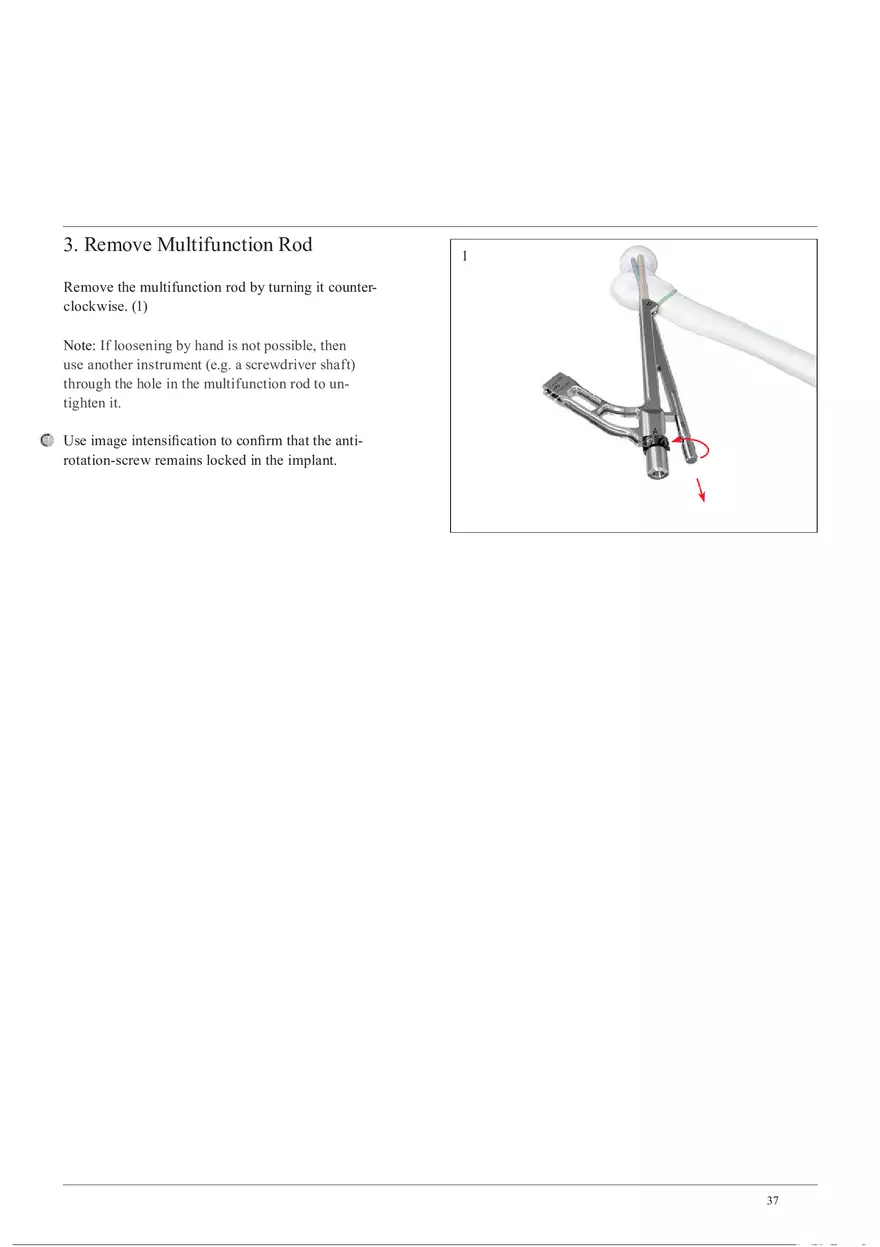 Femoral Neck Checking Option Intra-Operative Compression - Page 3