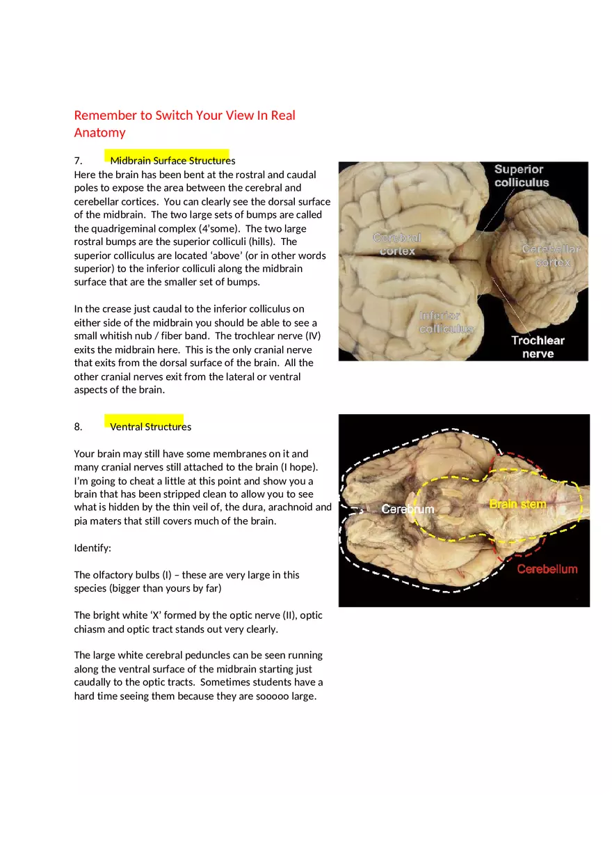 CNS Lab – Spinal Cord and Brain Features - Page 7