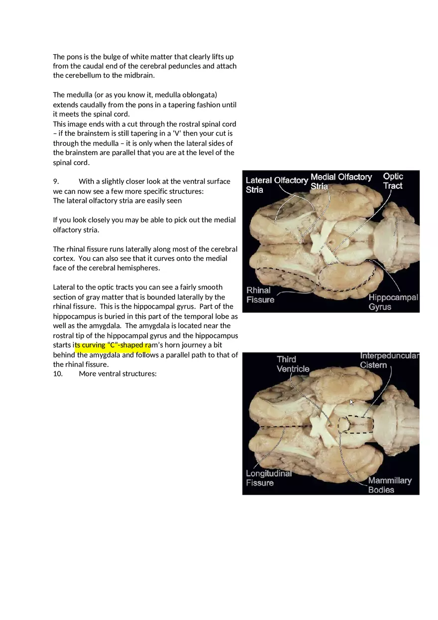 CNS Lab – Spinal Cord and Brain Features - Page 8