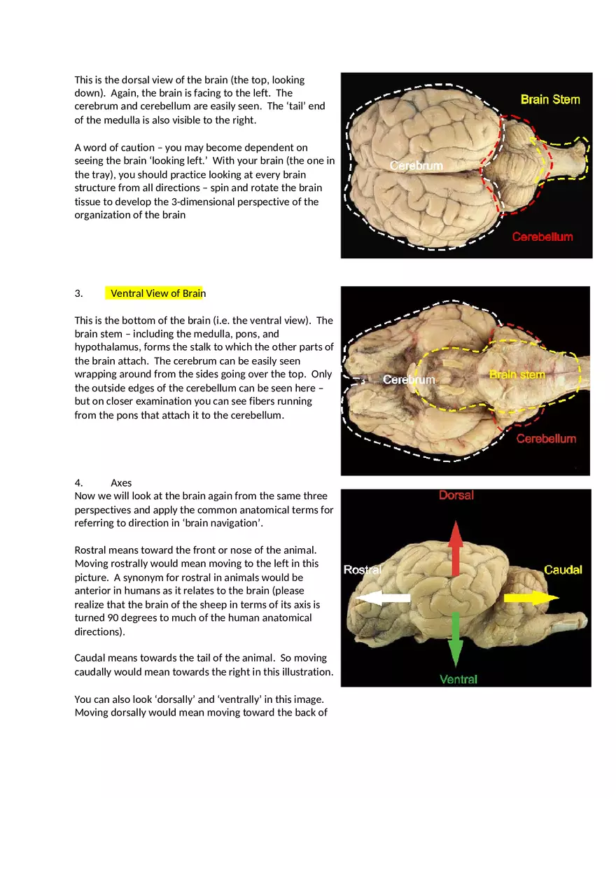 CNS Lab – Spinal Cord and Brain Features - Page 5