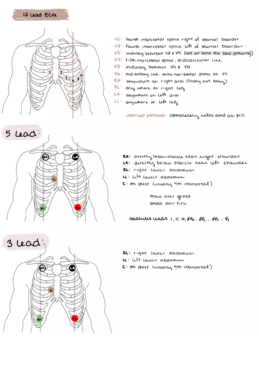 ECG Lead Placement - Page 1