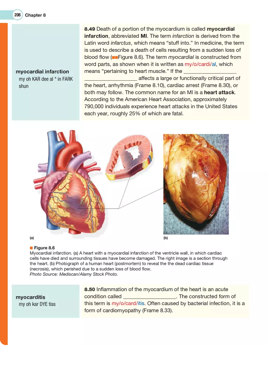 The Cardiovascular System Medical Terminology - Page 9