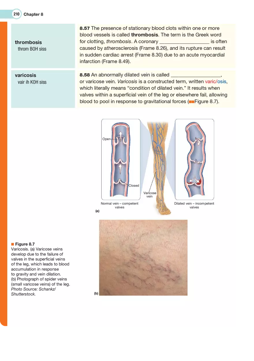 The Cardiovascular System Medical Terminology - Page 11