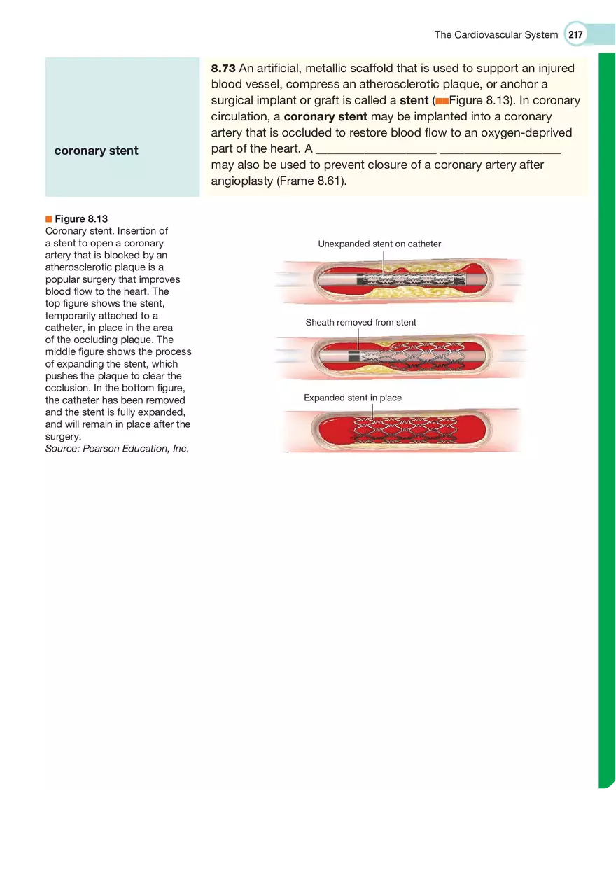 The Cardiovascular System Medical Terminology - Page 19