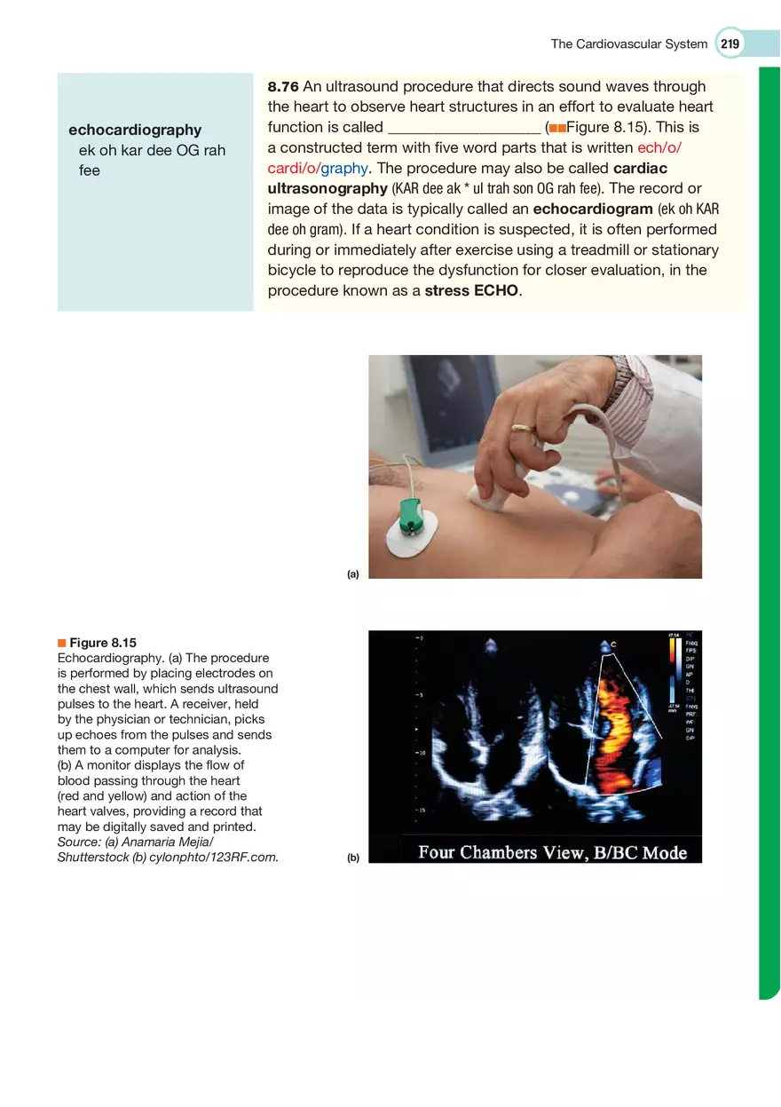 The Cardiovascular System Medical Terminology - Page 21