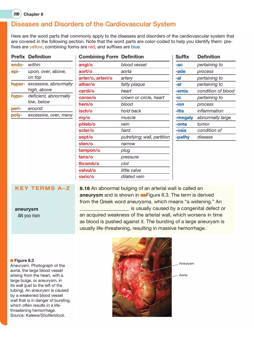 The Cardiovascular System Medical Terminology - Page 41