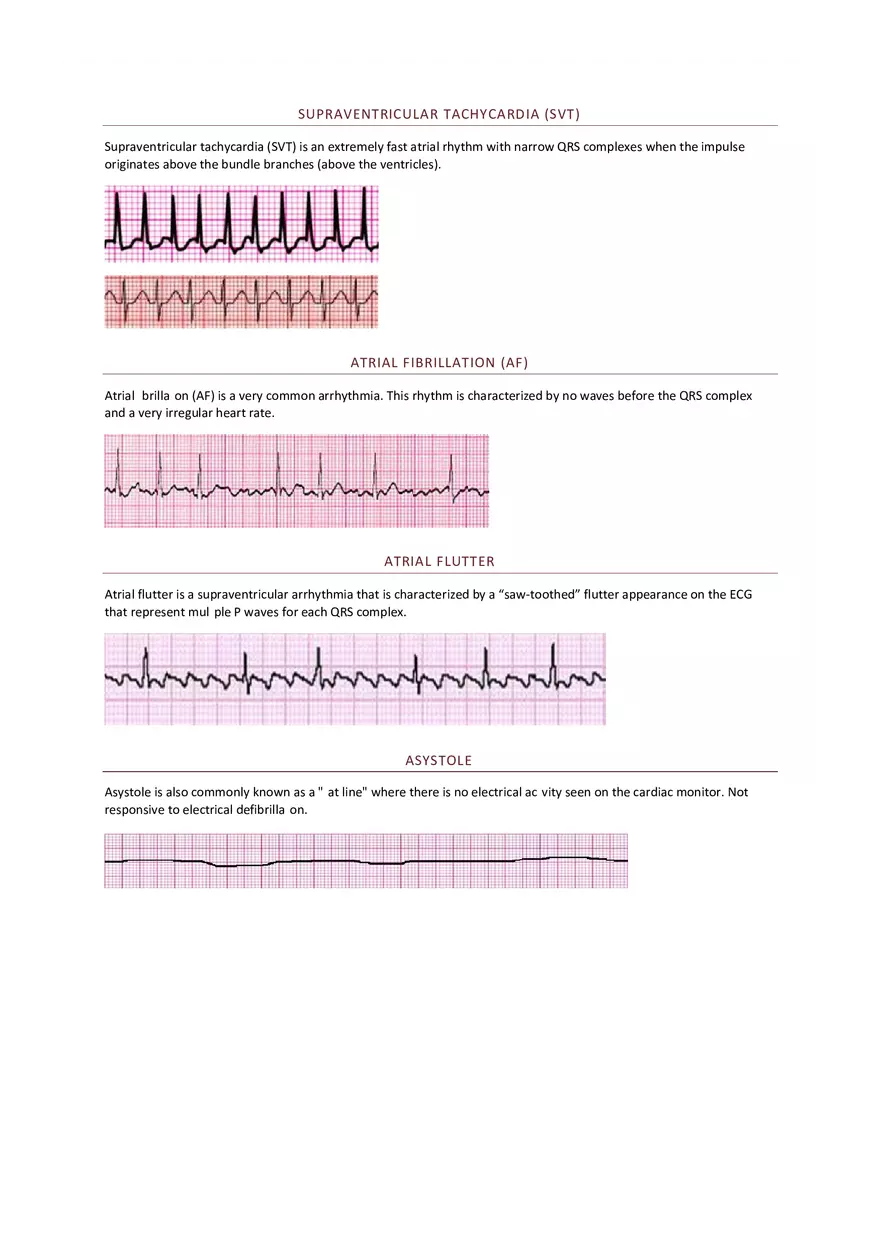 PALS Study Guide Part 5 - Page 3