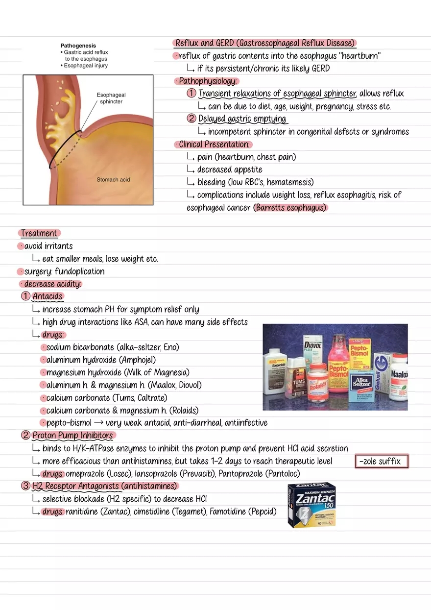 Lecture 3: GI Elimination 1 - Page 2