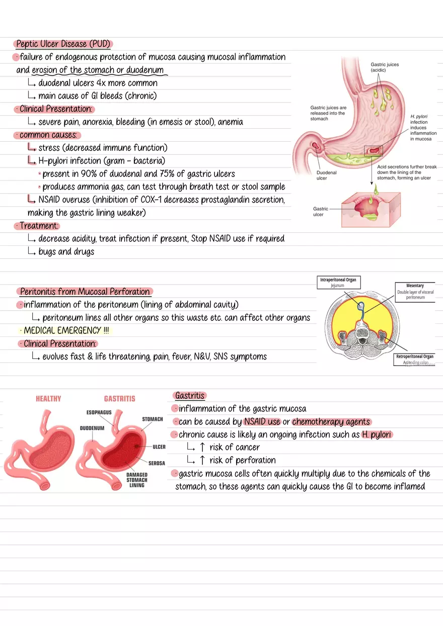 Lecture 3: GI Elimination 1 - Page 3