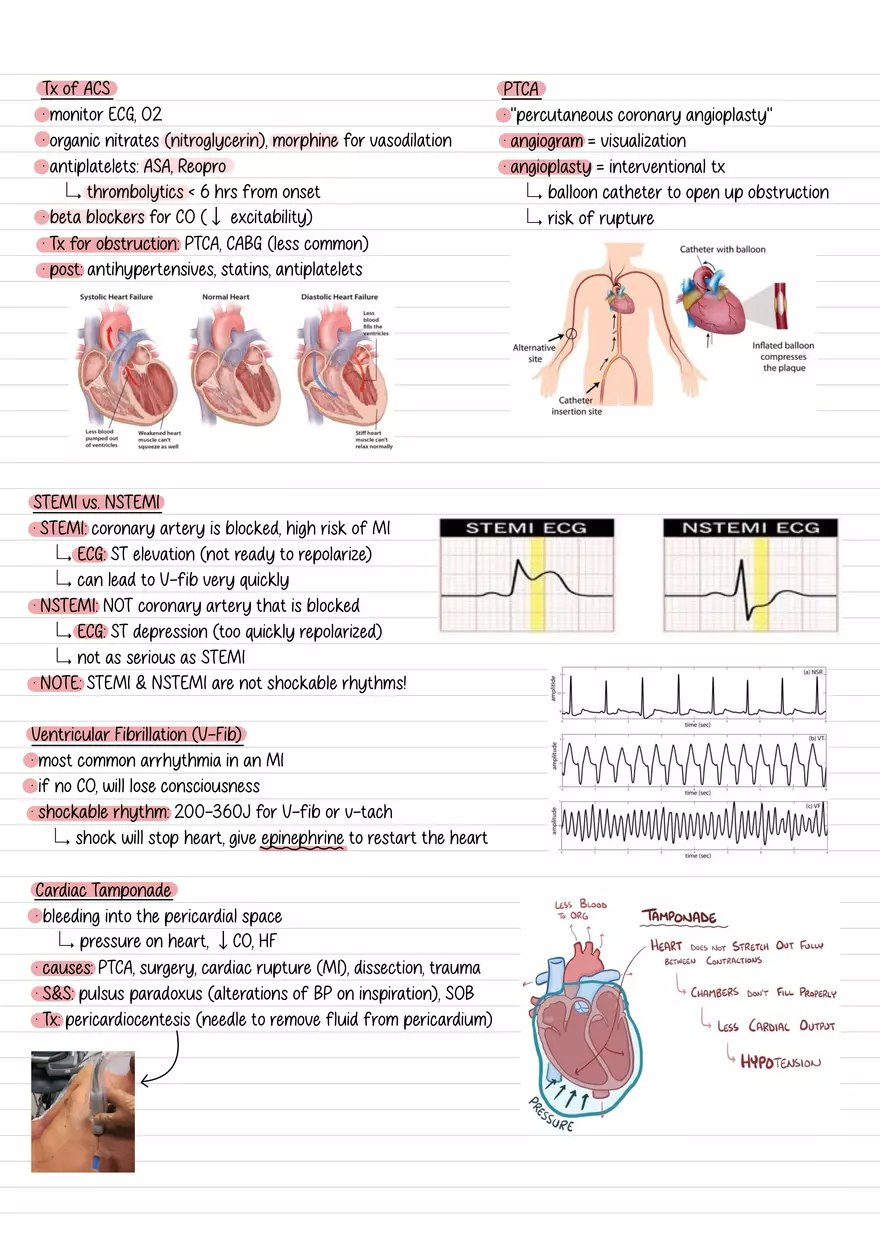 Lecture 8: Coagulation & CAD - Page 3