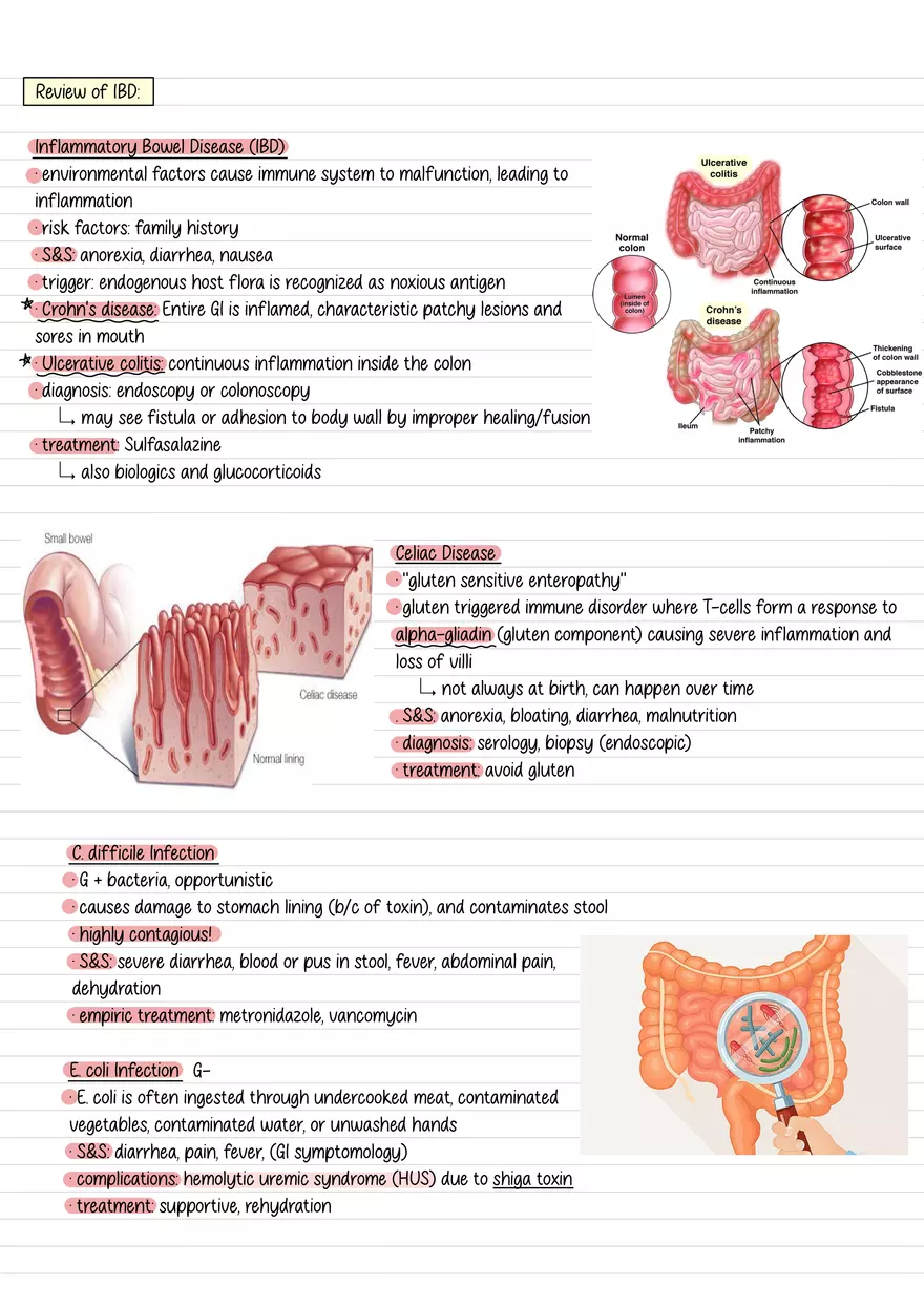 Lecture 4: GI Elimination 2 - Page 2