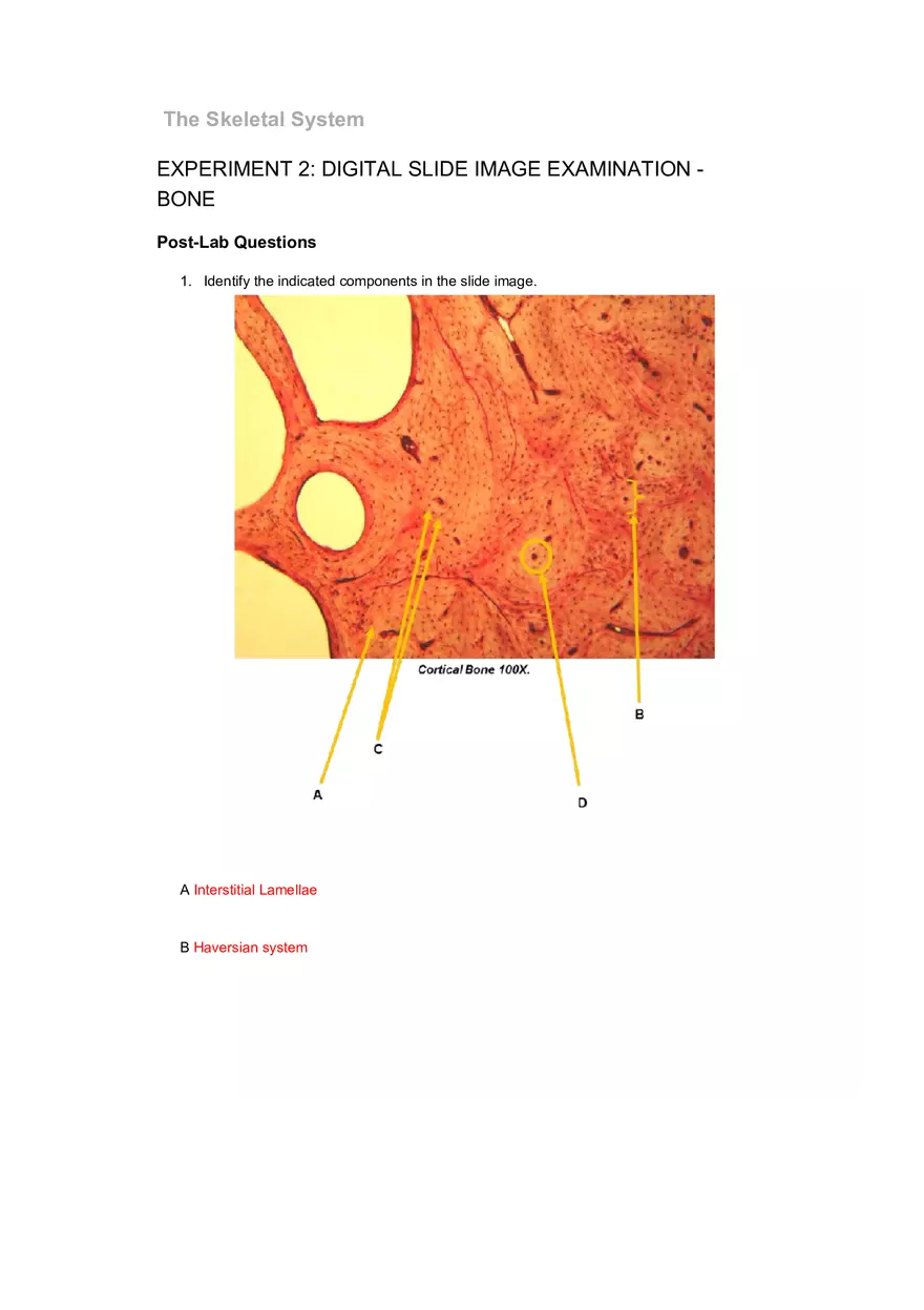 The Skeletal System Tables 6-16 - Page 4