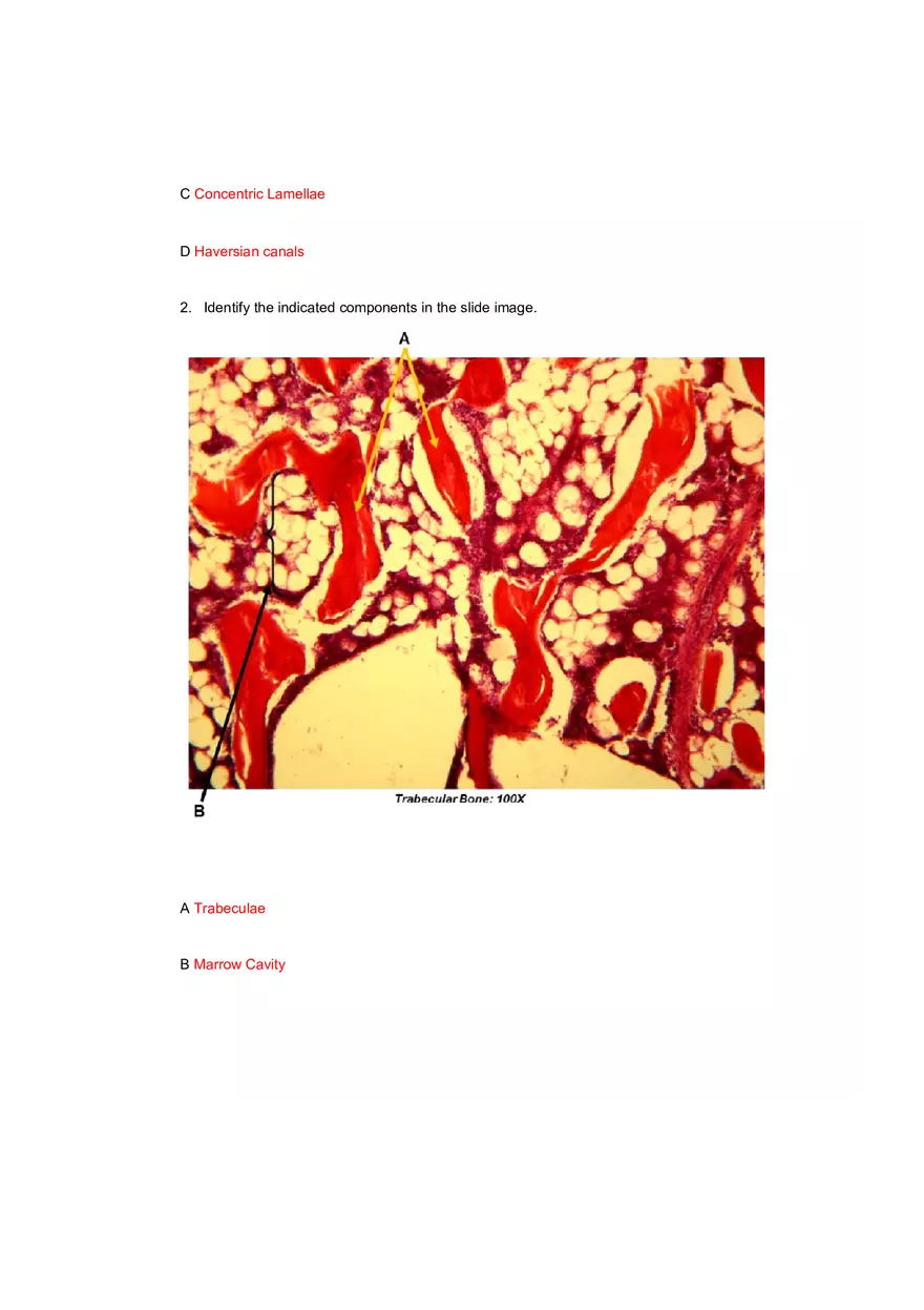 The Skeletal System Tables 6-16 - Page 5