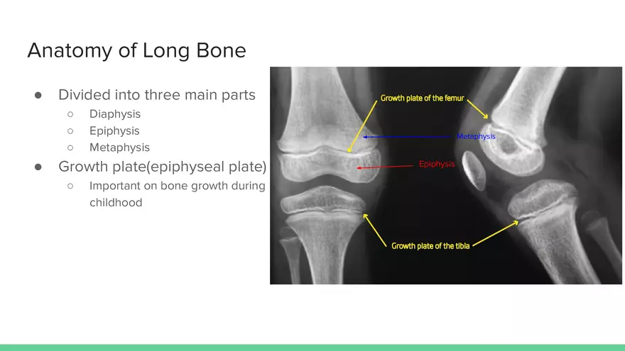 Understanding Epiphyseal Fractures - Page 3