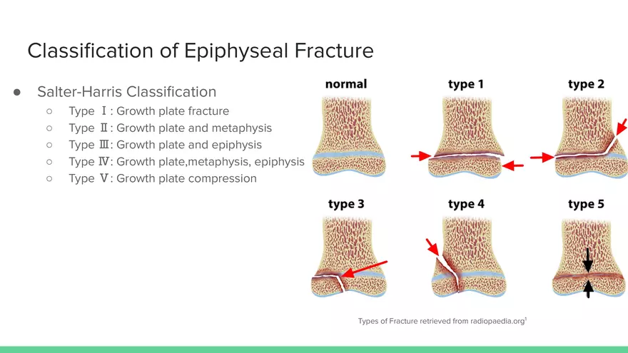 Understanding Epiphyseal Fractures - Page 4