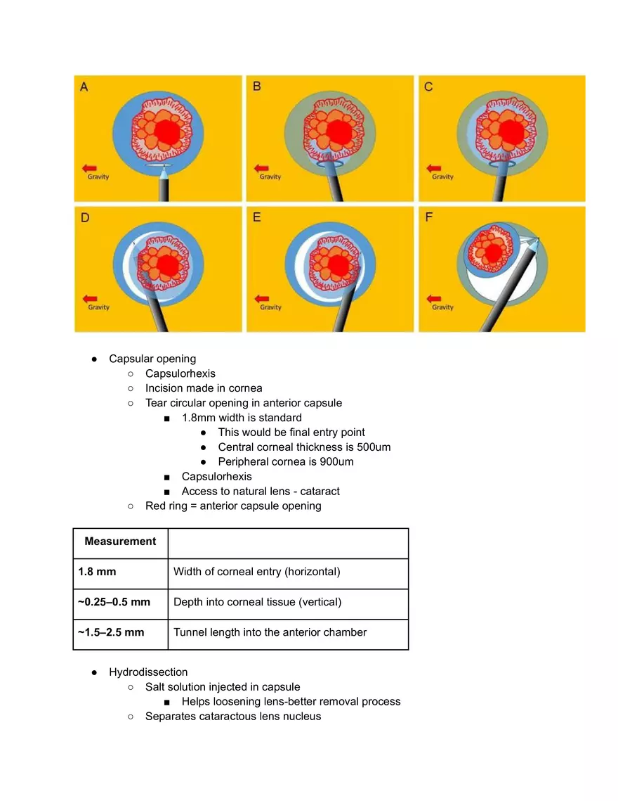 IOL Implant - Page 1
