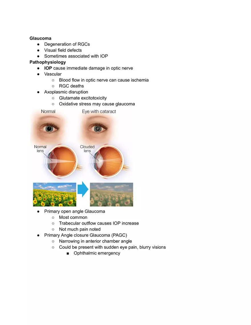 Glaucoma Study Notes - Page 1