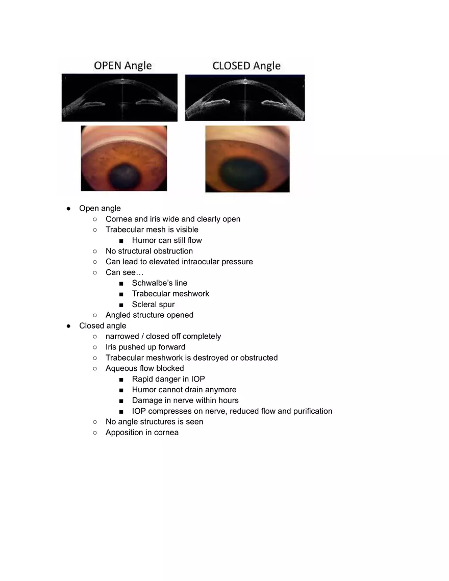 Glaucoma Study Notes - Page 2