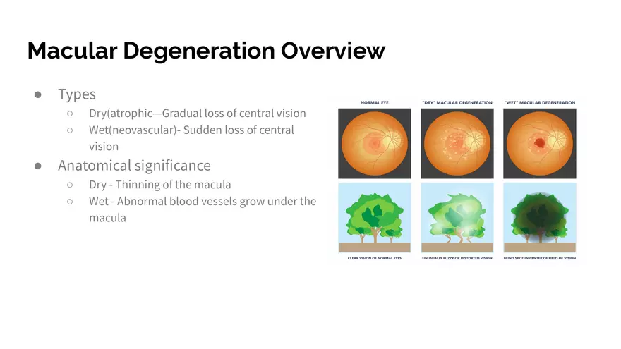 Understanding Macular Degeneration - Page 8