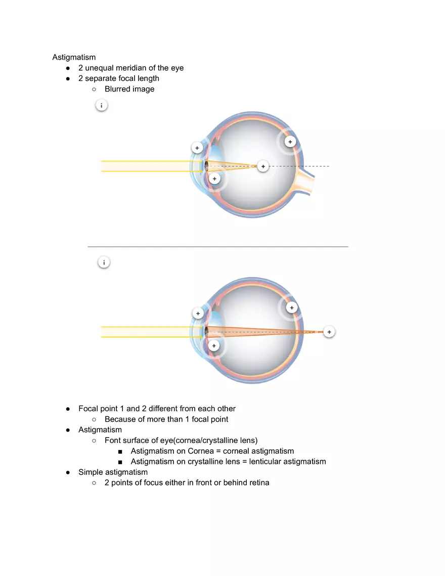Astigmatism Study Notes - Page 1