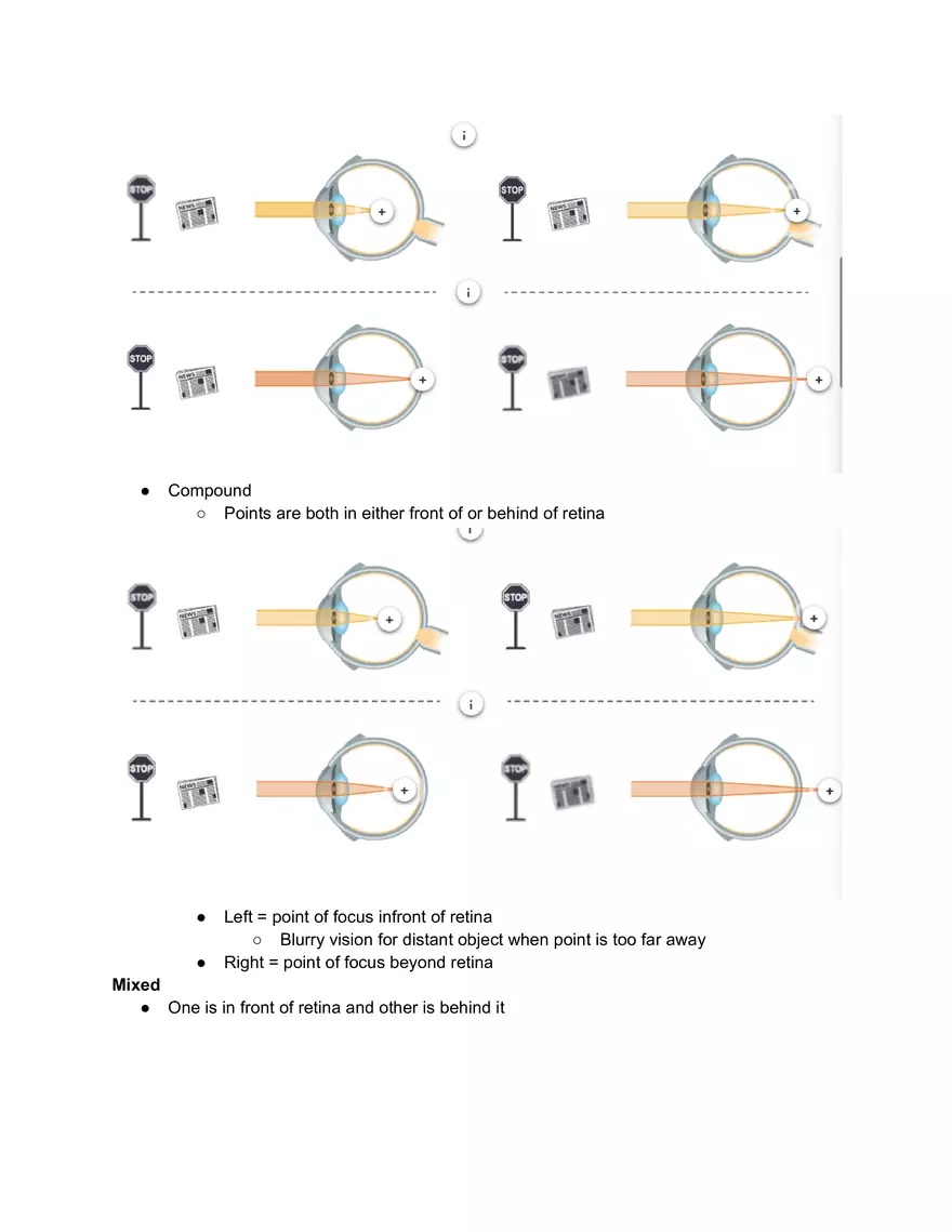 Astigmatism Study Notes - Page 2