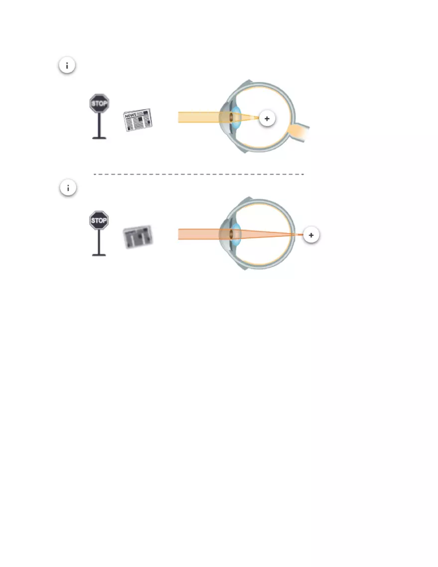 Astigmatism Study Notes - Page 3