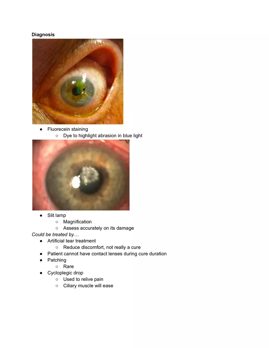Corneal Abrasion - Page 2