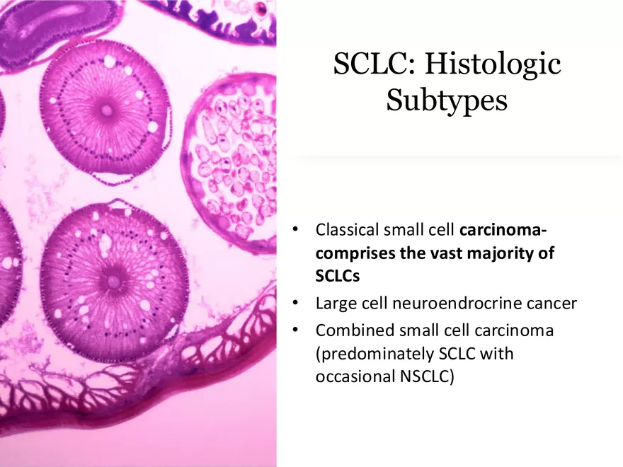 Lung Cancer Study Guide - Page 3