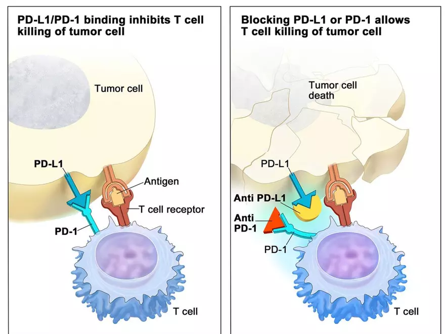 Lung Cancer Study Guide - Page 77