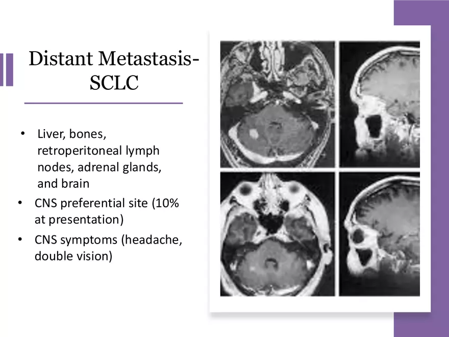 Lung Cancer Study Guide - Page 6