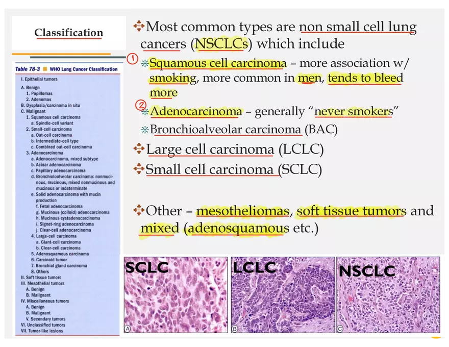 Lung Cancer Presentation - Page 35