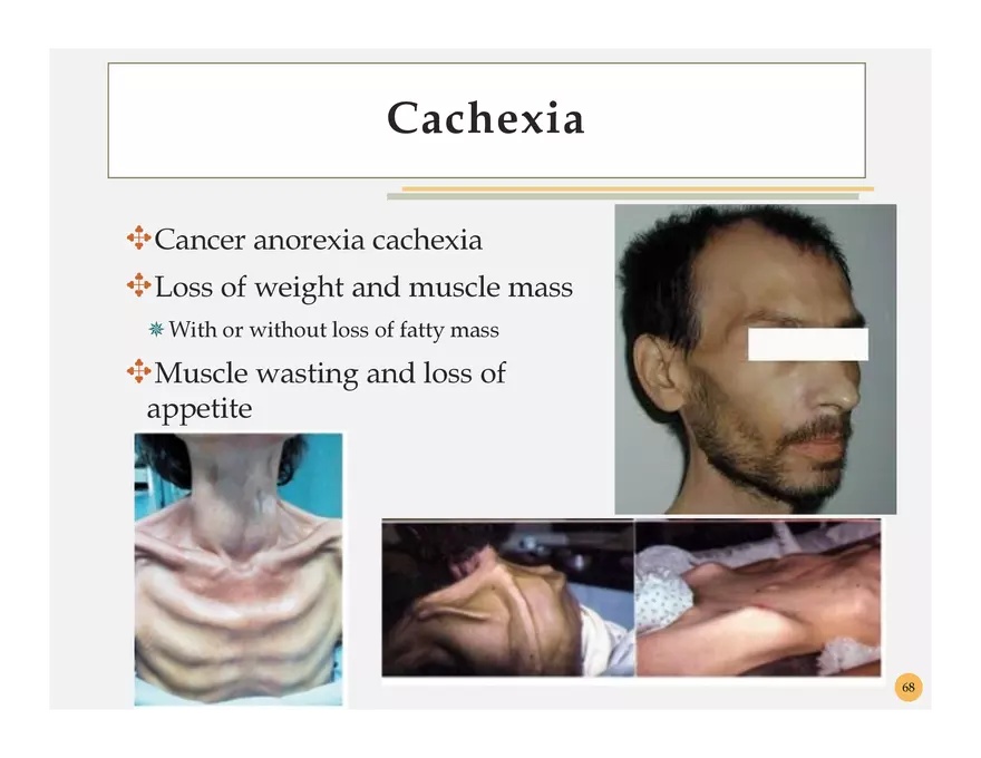 Pathophysiology: Cachexia - Page 2