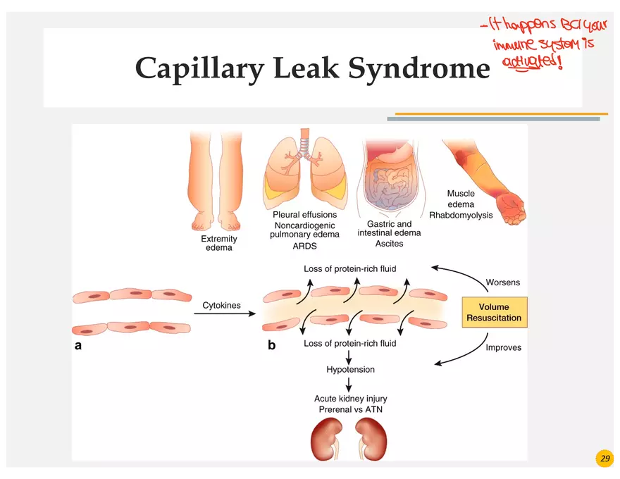 Skin Cancers Study Notes - Page 17