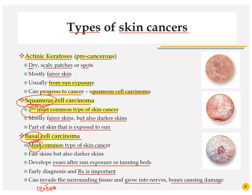 Skin Cancers Study Notes - Page 24