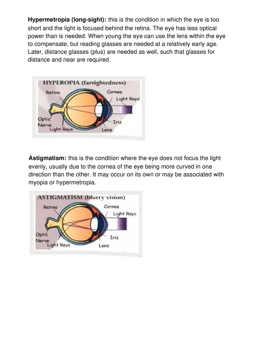 Ques 5 Write a Note Onrefractive Error of Eyes - Page 2