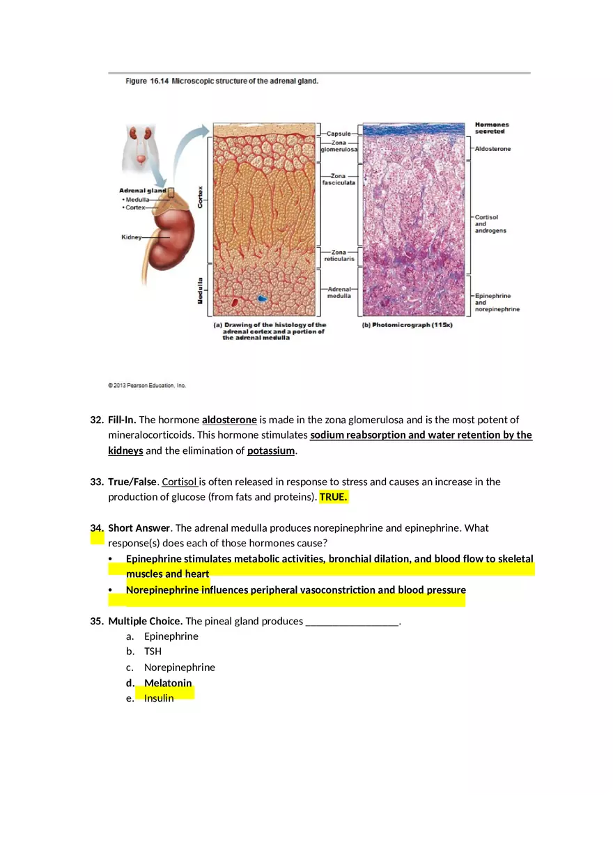 Ch. 16 – The Endocrine System – Answer Key - Page 6